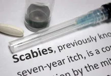 Ciri Penyakit Scabies dan Pantangan Makanan Penderita