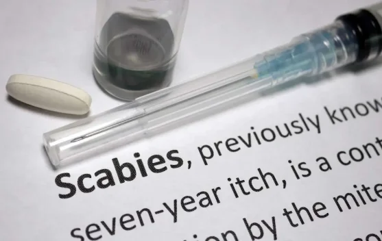 Ciri Penyakit Scabies dan Pantangan Makanan Penderita