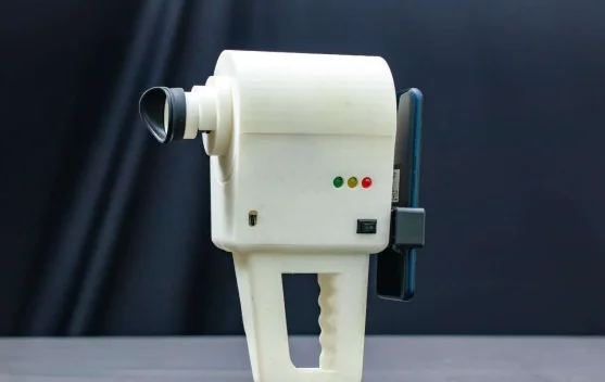 Retinopati Diabetik Ancam Risiko Kebutaan Permanen